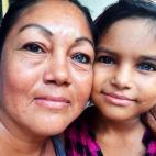 Una madre y su hija, con un ojo de cada color.