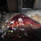 Se teme sin embargo que el número de fallecidos sea mucho mayor, con un número indeterminado de muertos encarcelados por el régimen de Bashar al-Ásad, los rebeldes y los yihadistas.