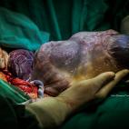 "El milagro de la vida en tus manos"