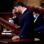 Abascal, en un gesto de cansancio.