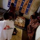 MSF atiende a Margaret Mafupa.