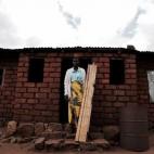 Elida Howa, paciente de cáncer cervical.