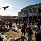 Blantyre, centro del programa de tratamiento de cáncer de cuello de útero de MSF.