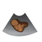 5c8aa7063b000037066c4e77