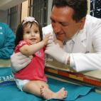 Niña sirenita: Milagros Cerrón, conocida como la niña 'sirenita' es una sobreviviente de esta condición. Nació con sus piernas pegadas desde las caderas hasta sus tobillos. Médicos lograron exitosamente separar sus piernas en Junio de 2005.