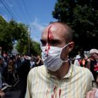 5c8a941b3b000072066c2520