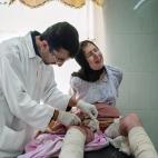 Haurin Khader, de 15 a&ntilde;os, es curada de sus heridas en el hospital Emergency de Erbil, capital de la Regi&oacute;n Aut&oacute;noma del Kurdist&aacute;n de Iraq. Su cuerpo es una llaga enrojecida de carne implantada y chamuscada desde que ...