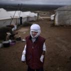En esta foto de archivo del 11 de diciembre de 2012, Abdullah Ahmed, de 10 años, que sufrió quemaduras en un ataque aéreo del gobierno sirio y huyó de su casa con su familia, posa afuera de su tienda de campaña en un campo de refugiados sir...