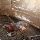 Un hombre herido yace atrapado por un coche tras la explosi&oacute;n en el puerto de Beirut del 4 de agosto.