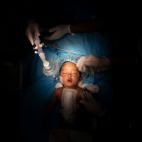 Yazan, una ni&ntilde;a de un a&ntilde;o residente en el desierto, operada en Libia por el equipo del doctor William Novick, que ayuda a personas sin asistencia.