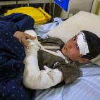 Menor herido durante el terremoto.