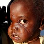 La peque&ntilde;a Racahele-Ngabausi, de dos a&ntilde;os.