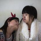 Nguyen Thi Van Long (derecha) y su mejor amiga Dinh Thi Huong, que es sorda y muda, juntas en la Friendship Village, un hospital para víctimas del agente naranja en Hanoi. Los padres de ambas eran soldado. 120 niños y 60 veteranos de guerra es...