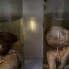 Fetos deformados en botes de cristal en la sala de exposición del Peace Village del Hospital de Tu Du. Más de dos tercios de los pacientes que tratan sufren enfermedades o deformaciones causadas por el agente naranja.