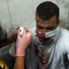 5c8a93052300005300e6bbd0