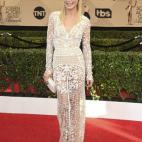 5c8abaff240000f404a39449