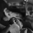 Victims of the Zika Virus, Lalo de Almeida, Brazil.