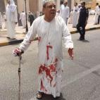 5c8b6b912400006c05a4ab76