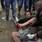 5c8b3917230000d50424677b