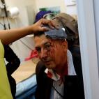 5c8a908620000043046f4e21