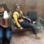 Dos mujeres heridas en las explosiones del aeropuerto. Imagen de Georgian Public Broadcaster, fotografía de Ketevan Kardava.