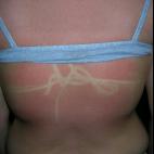 Si escoges un bikini fino pero luego te duermes al sol también te queda marca