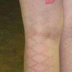 El verano no es momento de ponerse medias que te vayan a tatuar