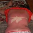 Estabas muy a gustito, pero no debiste quedarte dormida al sol... tantas horas