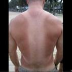 Ojo con la ropa de verano