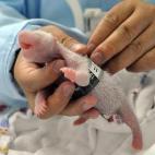 Un experto toma medidas a uno de los trillizos en su segundo día de vida (30/07/2014).