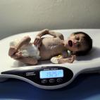 5c8a43062400000a05a2d896