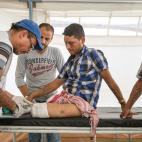 Campo de desplazados de Ain Issa. El fisioterapeuta de MSF Michaël Roriz trata a Ahmad, que escapó de Raqqa tras tres meses de asedio. Su mujer y sus dos hijas murieron y su casa fue destruida en un bombardeo de las fuerzas de la coalición. M...