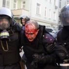 5c8b18fe360000a61b6c73d1