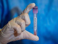 ANKARA, TURKIYE - MAY 06: In this photo illustration Hantavirus samples are seen in Ankara, Turkiye on May 06,, 2026. (Photo by Arman Onal/Anadolu via Getty Images)