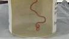 Imagen del gusano que fue extraído del cerebro de una mujer en un hospital de Canberra (Australia).