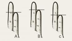 Acertijo visual de los dedos meñiques