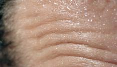 Detalle de una frente sudorosa.
