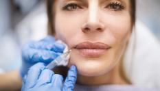 Aumento de labios con ácido hialurónico.