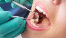 Imagen de archivo de un dentista revisando a un paciente.