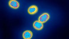 La Brucella, el género de bacterias responsable de producir la brucelosis