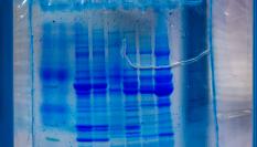 Investigadores de UC Riverside han encontrado una manera de controlar la proteína responsable del agravamiento de la mayoría de los cánceres.