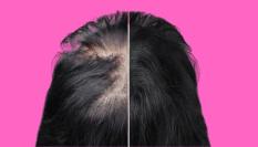 Polvo para rellenar el cabello más vendido de Amazon