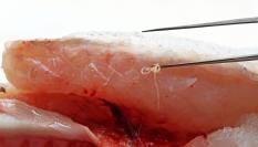 Extracción de un parásito Anisakis de un pescado.