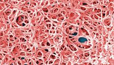 Vista microscópica de la bacteria que causa la enfermedad de Lyme y que transmiten insectos como las garrapatas.