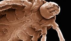 Imagen de la vista inferior de una garrapata común.