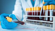 Análisis de sangre.