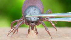 Ilustración digital de la retirada de una garrapata.