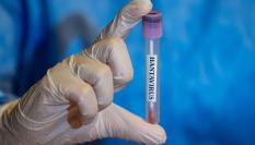 ANKARA, TURKIYE - MAY 06: In this photo illustration Hantavirus samples are seen in Ankara, Turkiye on May 06,, 2026. (Photo by Arman Onal/Anadolu via Getty Images)