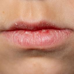 Jerónimo, experto farmacéutico, sobre cómo proteger los labios del frío: "Hay una planta especialmente potente, 'la sangre de dragón"