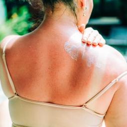 Reutilizar la crema solar del año pasado: se puede o no